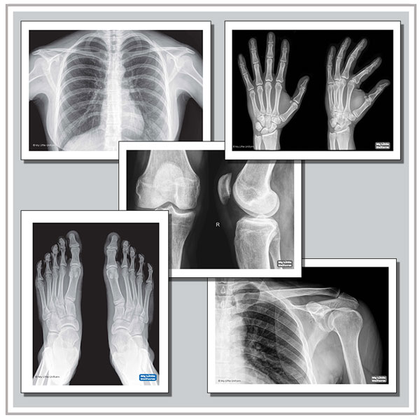 Doctor’s Surgery X-rays